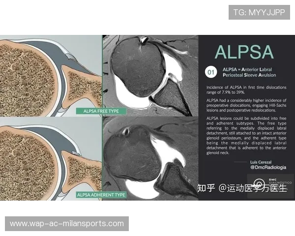 凯斯勒左肩关节盂唇撕裂，本赛季报销！内线低迷让球队头疼